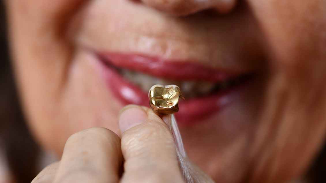 Eine Frau hält einen goldenen Zahn in die Kamera Symbolfoto: Joko (imago)